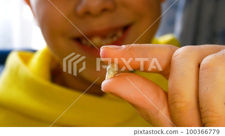A child holds a pulled milk tooth near the open mouth next to the new growing permanent teeth A child holds a pulled milk tooth near the open mouth next to the new growing permanent teeth 100366779