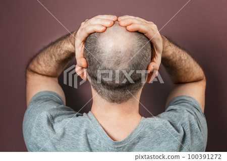 Self-doubt and inferiority complex. Baldy adult man grabs his head with his hands. Rear view. Brown background. The concept of alopecia and baldness Self-doubt and inferiority complex. Baldy adult man grabs his head with his hands. Rear view. Brown background. The concept of alopecia and baldness 100391272
