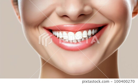 Woman beauty smile white teeth. Stomatology concept. Generative AI 100400270