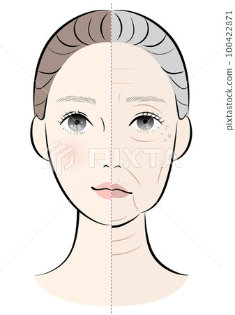 Comparison of the face of a young woman and an aging woman 100422871
