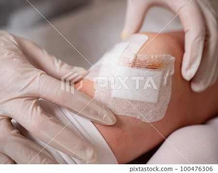 Close-up of the hands of a nurse in sterile gloves at the knee of a patient sticking a sterile patch during dressing after arthroscopy surgery. Close-up of the hands of a nurse in sterile gloves at the knee of a patient sticking a sterile patch during dressing after arthroscopy surgery. 100476306