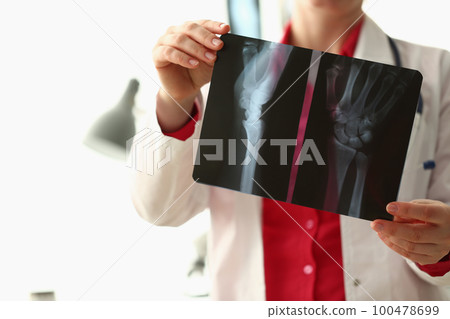 Orthopedist examines x-ray of patient hand in clinic 100478699