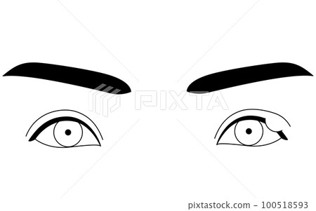 Medical illustration, line drawing illustration of eye disease / stye (chalazion) 100518593