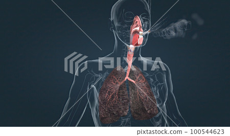 Smoking irritates the lungs over time Smoking irritates the lungs over time 100544623