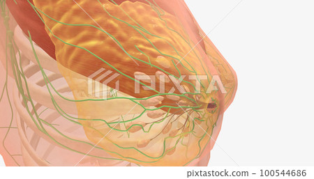 Stage I breast tumors are invasive and have started to spread to the fatty breast tissue or to nearby lymph nodes. Stage I breast tumors are invasive and have started to spread to the fatty breast tissue or to nearby lymph nodes. 100544686