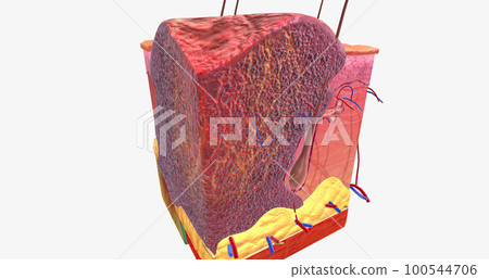 Basal Cell Carcinoma in Tissue, Stage III 100544706
