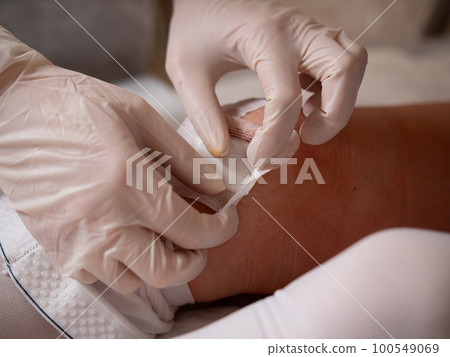 The process of replacing a sterile patch on the patient's knee after surgery. The process of replacing a sterile patch on the patient's knee after surgery. 100549069