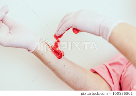 Shugaring master applying thick sugar paste on lady's hand, removing unwanted hair. Hair removal with a special sugar paste has many advantages over wax depilation 100586861