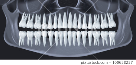 Realistic Teeth X-Ray Realistic Teeth X-Ray 100638237