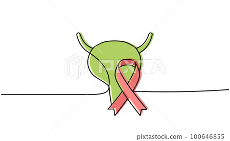 Human bladder with ribbon one line colored continuous drawing. Cancer awareness ribbon, AIDS tape continuous one line colorful illustration. Human bladder with ribbon one line colored continuous drawing. Cancer awareness ribbon, AIDS tape continuous one line colorful illustration. 100646855