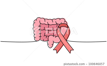 Human intestines with ribbon one line colored continuous drawing. Cancer awareness ribbon, AIDS tape continuous one line colorful illustration. Human intestines with ribbon one line colored continuous drawing. Cancer awareness ribbon, AIDS tape continuous one line colorful illustration. 100646857