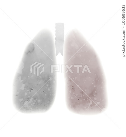 Vector watercolor illustration of diseased lungs. Smoky respiratory system. Silhouette gray from smoke lungs 100699632