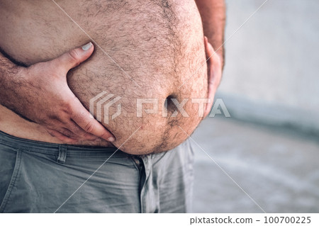 Close-up of a man's round and full hairy belly, with both hands holding it up Close-up of a man's round and full hairy belly, with both hands holding it up 100700225