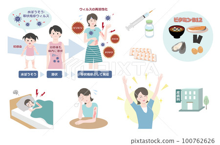 A set of illustrations about shingles (young woman), which is said to affect one in three people 100762626