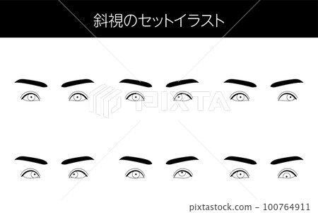 Medical illustration, illustrated set illustration of eye disease and strabismus 100764911