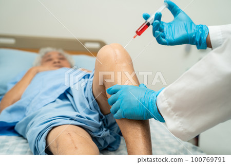 Asian doctor inject Hyaluronic acid platelet rich plasma into the knee of senior woman to walk without pain. Asian doctor inject Hyaluronic acid platelet rich plasma into the knee of senior woman to walk without pain. 100769791