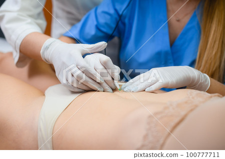 Female hands in gloves during spa electrolysis 100777711