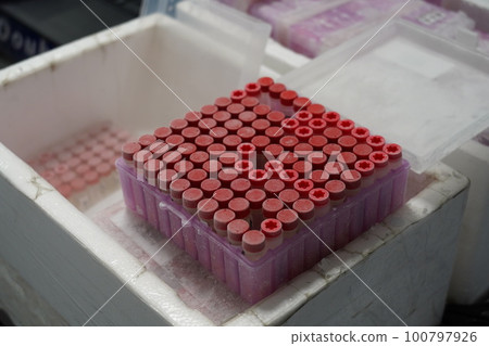 血液檢體 100797926