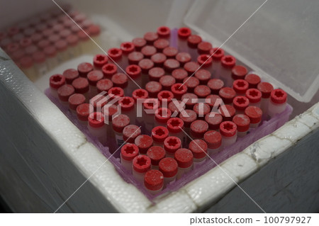 血液檢體 血液檢體 100797927