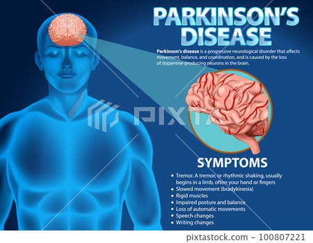 Informative poster of Parkinson disease Informative poster of Parkinson disease 100807221