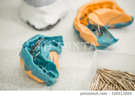Denture concept 100813860
