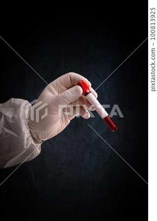 Test tube with blood Test tube with blood 100813925