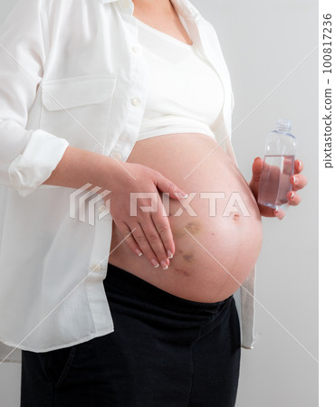 Pregnant woman applying cosmetic oil on her belly for healing puncture marks, bruises and stretches Pregnant woman applying cosmetic oil on her belly for healing puncture marks, bruises and stretches 100817236