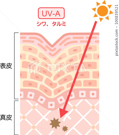 Ultraviolet rays UV-A cross section of skin 100839521