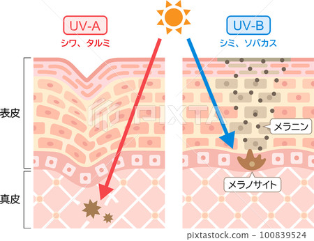 UV Rays Difference between UV-A and UV-B Cross-sectional view of skin UV Rays Difference between UV-A and UV-B Cross-sectional view of skin 100839524