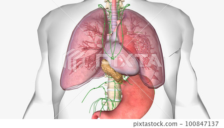 In stage III esophageal cancer, the tumor has spread through the layers of the esophageal wall. In stage III esophageal cancer, the tumor has spread through the layers of the esophageal wall. 100847137