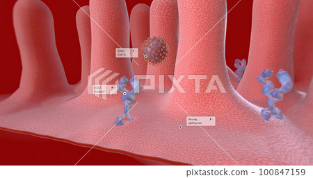 Attack on air cells by SARS-CoV-2, which causes COVID-19. Attack on air cells by SARS-CoV-2, which causes COVID-19. 100847159
