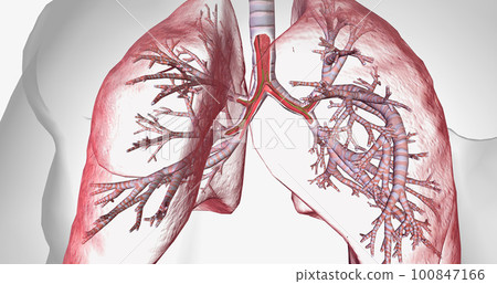 Cystic fibrosis is a genetically inherited disease that affects secretory cells throughout the body. Cystic fibrosis is a genetically inherited disease that affects secretory cells throughout the body. 100847166