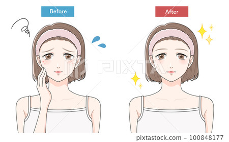 患痤瘡前後的婦女 患痤瘡前後的婦女 100848177