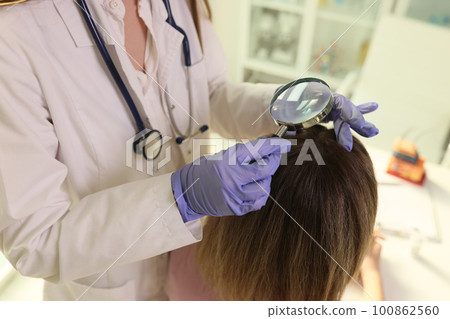 Trichologist finds out cause of hair loss of female patient Trichologist finds out cause of hair loss of female patient 100862560
