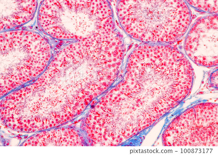 Anatomy and Histological Epididymis and Testis human cells under microscope. Anatomy and Histological Epididymis and Testis human cells under microscope. 100873177