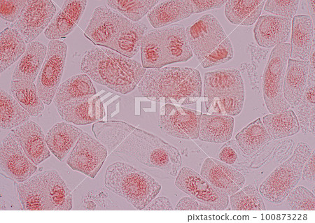 Root tip of Onion and Mitosis cell in the Root tip of Onion under a microscope. Root tip of Onion and Mitosis cell in the Root tip of Onion under a microscope. 100873228