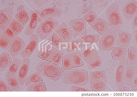 Root tip of Onion and Mitosis cell in the Root tip of Onion under a microscope. 100873230