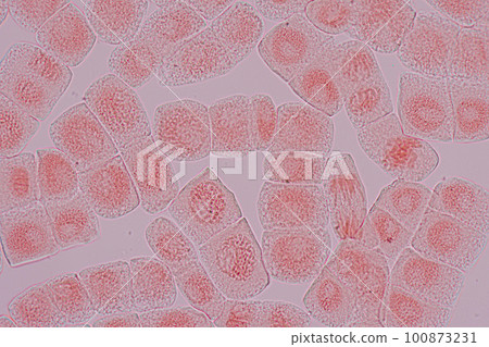 Root tip of Onion and Mitosis cell in the Root tip of Onion under a microscope. Root tip of Onion and Mitosis cell in the Root tip of Onion under a microscope. 100873231