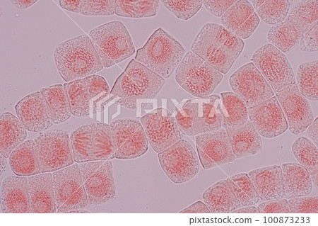 Root tip of Onion and Mitosis cell in the Root tip of Onion under a microscope. Root tip of Onion and Mitosis cell in the Root tip of Onion under a microscope. 100873233