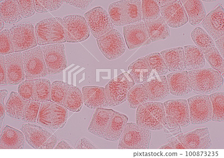 Root tip of Onion and Mitosis cell in the Root tip of Onion under a microscope. Root tip of Onion and Mitosis cell in the Root tip of Onion under a microscope. 100873235