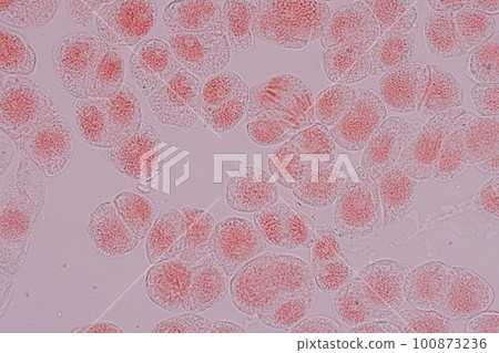 Root tip of Onion and Mitosis cell in the Root tip of Onion under a microscope. Root tip of Onion and Mitosis cell in the Root tip of Onion under a microscope. 100873236