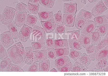 Root tip of Onion and Mitosis cell in the Root tip of Onion under a microscope. Root tip of Onion and Mitosis cell in the Root tip of Onion under a microscope. 100873239