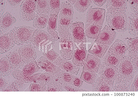 Root tip of Onion and Mitosis cell in the Root tip of Onion under a microscope. Root tip of Onion and Mitosis cell in the Root tip of Onion under a microscope. 100873240