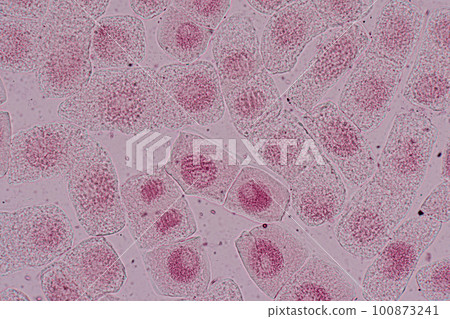 Root tip of Onion and Mitosis cell in the Root tip of Onion under a microscope. Root tip of Onion and Mitosis cell in the Root tip of Onion under a microscope. 100873241