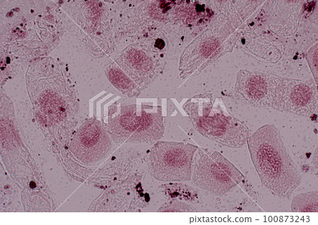 Root tip of Onion and Mitosis cell in the Root tip of Onion under a microscope. 100873243