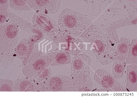 Root tip of Onion and Mitosis cell in the Root tip of Onion under a microscope. Root tip of Onion and Mitosis cell in the Root tip of Onion under a microscope. 100873245