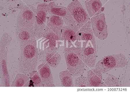 Root tip of Onion and Mitosis cell in the Root tip of Onion under a microscope. Root tip of Onion and Mitosis cell in the Root tip of Onion under a microscope. 100873246