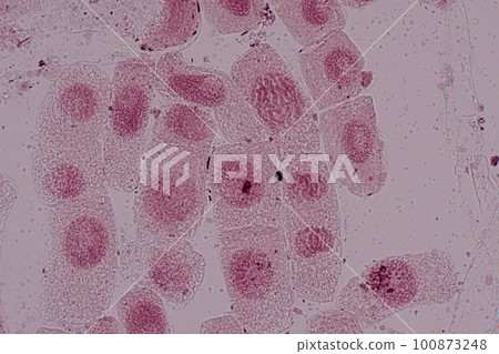 Root tip of Onion and Mitosis cell in the Root tip of Onion under a microscope. Root tip of Onion and Mitosis cell in the Root tip of Onion under a microscope. 100873248