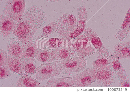 Root tip of Onion and Mitosis cell in the Root tip of Onion under a microscope. Root tip of Onion and Mitosis cell in the Root tip of Onion under a microscope. 100873249