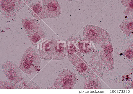 Root tip of Onion and Mitosis cell in the Root tip of Onion under a microscope. Root tip of Onion and Mitosis cell in the Root tip of Onion under a microscope. 100873250